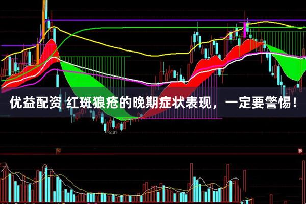 优益配资 红斑狼疮的晚期症状表现，一定要警惕！