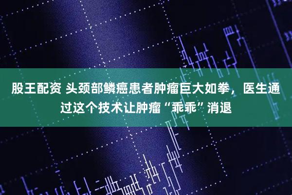 股王配资 头颈部鳞癌患者肿瘤巨大如拳，医生通过这个技术让肿瘤“乖乖”消退
